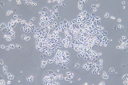 人乳腺癌细胞AU565(STR鉴定) | EnkiLife恩玑生命