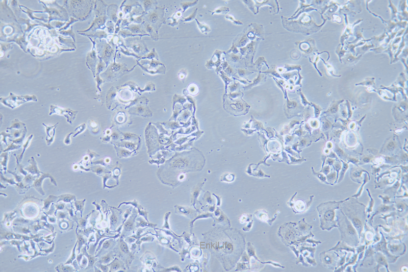 人乳腺癌细胞BT-20(STR鉴定) | EnkiLife恩玑生命