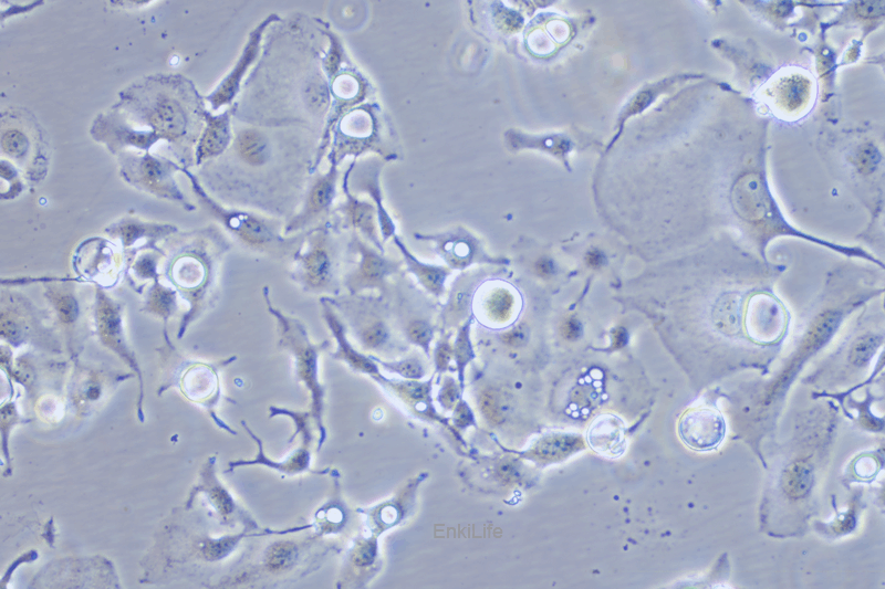 人乳腺癌细胞BT-20(STR鉴定) | EnkiLife恩玑生命