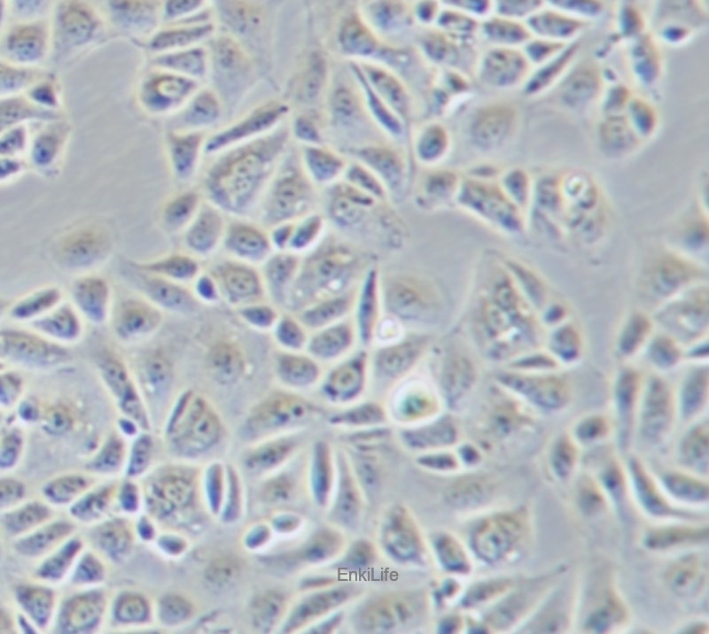 人乳腺癌细胞CAL-51（STR鉴定） | EnkiLife恩玑生命