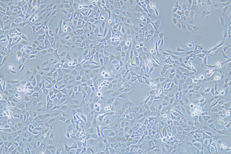 人乳腺癌细胞SUM149PT(STR鉴定) | EnkiLife恩玑生命