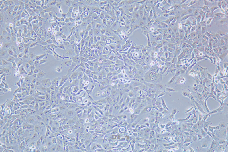 人乳腺癌细胞SUM149PT(STR鉴定) | EnkiLife恩玑生命