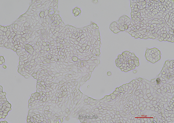 人乳腺导管瘤细胞UACC-812(STR鉴定) | EnkiLife恩玑生命