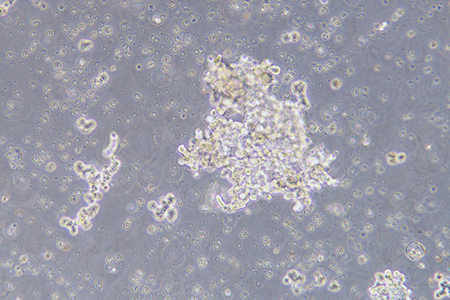 人乳腺上皮细胞DU4475(STR鉴定) | EnkiLife恩玑生命