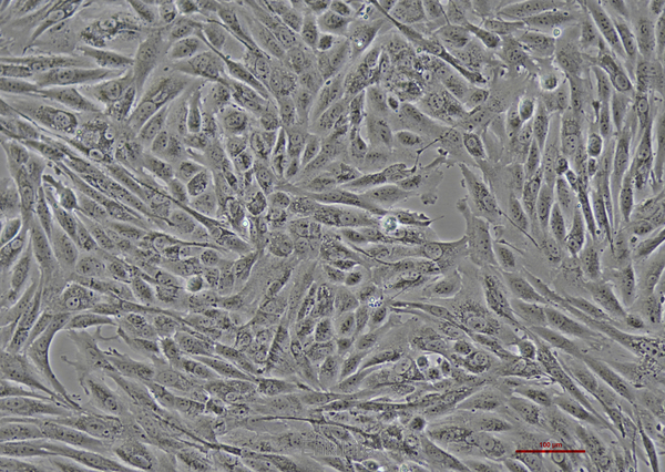 人软骨肉瘤细胞SW 1353(STR鉴定) | EnkiLife恩玑生命