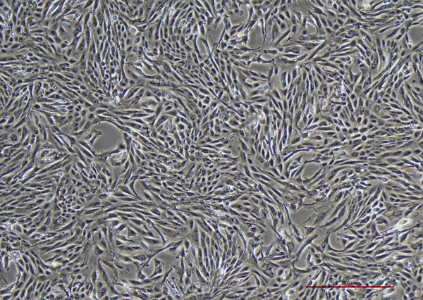 人软骨肉瘤细胞SW 1353(STR鉴定) | EnkiLife恩玑生命