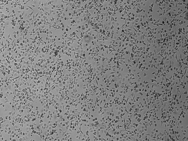 人上皮性卵巢癌细胞TOV-112D(STR鉴定) | EnkiLife恩玑生命