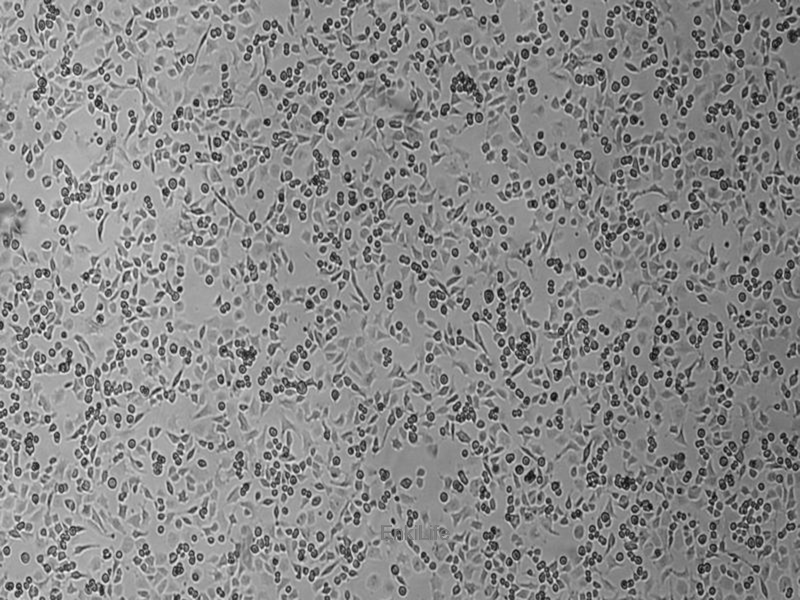 人上皮性卵巢癌细胞TOV-112D(STR鉴定) | EnkiLife恩玑生命