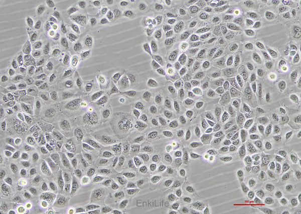 人舌鳞癌细胞SCC-25(STR鉴定) | EnkiLife恩玑生命