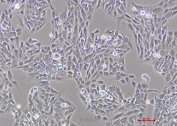 人神经母细胞瘤细胞SK-N-AS(STR鉴定) | EnkiLife恩玑生命