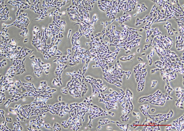 人神经母细胞瘤细胞SK-N-AS(STR鉴定) | EnkiLife恩玑生命