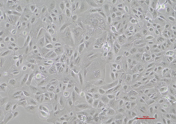 人肾癌细胞OS-RC-2(STR鉴定) | EnkiLife恩玑生命