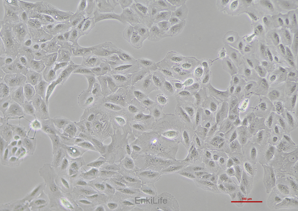 人肾癌细胞OS-RC-2(STR鉴定) | EnkiLife恩玑生命