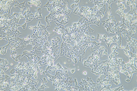 人肾上腺皮质腺癌细胞NCI-H295R(STR鉴定) | EnkiLife恩玑生命