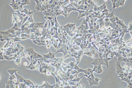 人肾上腺皮质腺癌细胞NCI-H295R(STR鉴定) | EnkiLife恩玑生命