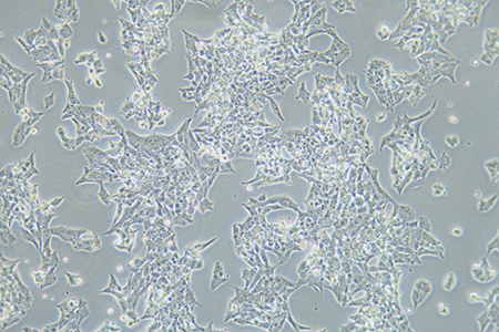 人肾上腺皮质腺癌细胞NCI-H295R(STR鉴定) | EnkiLife恩玑生命
