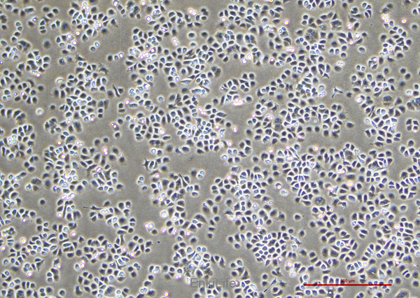 人肾上腺皮质小细胞癌细胞SW-13(STR鉴定) | EnkiLife恩玑生命