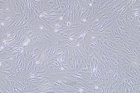 人肾透明细胞癌皮肤转移细胞Caki-1(STR鉴定) | EnkiLife恩玑生命