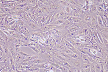 人肾透明细胞癌皮肤转移细胞Caki-1(STR鉴定) | EnkiLife恩玑生命