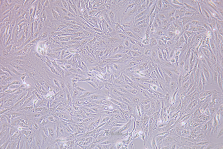人肾透明细胞癌皮肤转移细胞Caki-1(STR鉴定) | EnkiLife恩玑生命