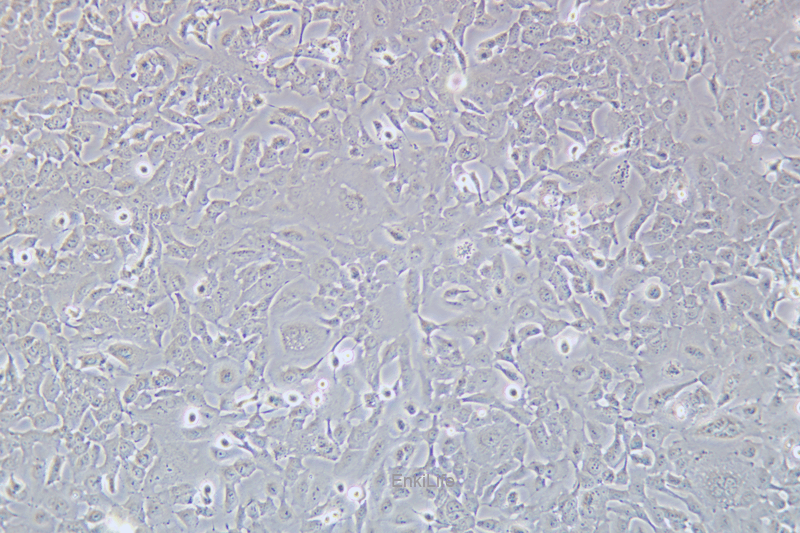 人食道癌肿瘤细胞SK-GT-4(STR鉴定) | EnkiLife恩玑生命