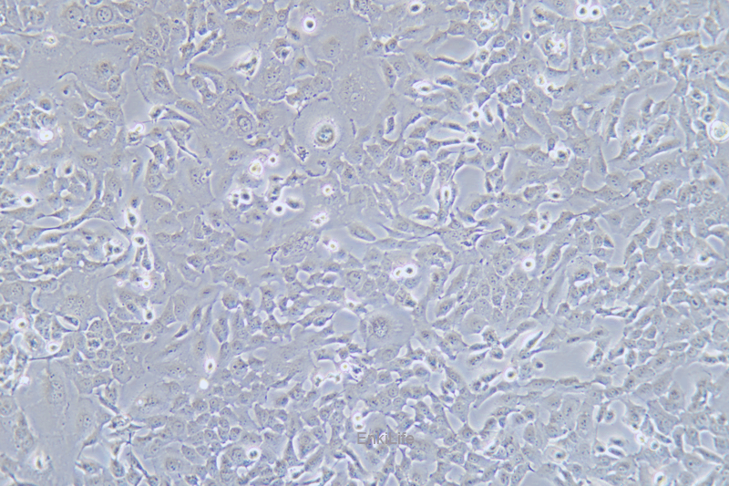 人食道癌肿瘤细胞SK-GT-4(STR鉴定) | EnkiLife恩玑生命