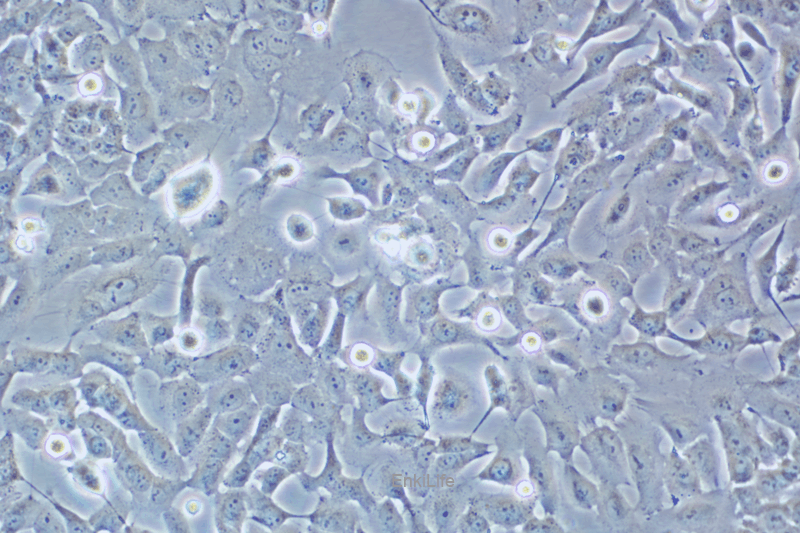 人食道癌肿瘤细胞SK-GT-4(STR鉴定) | EnkiLife恩玑生命