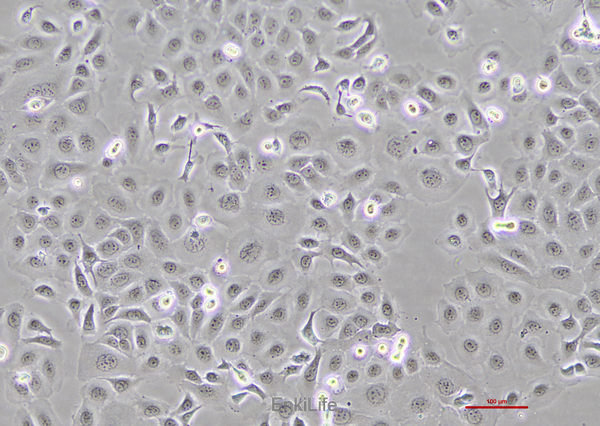 人食管癌细胞TE-1(STR鉴定) | EnkiLife恩玑生命