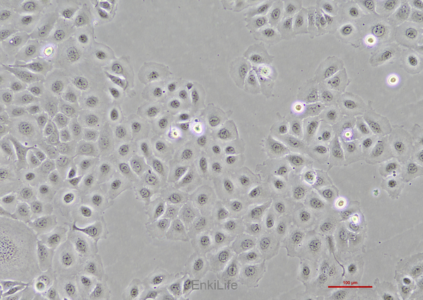 人食管癌细胞TE-1(STR鉴定) | EnkiLife恩玑生命