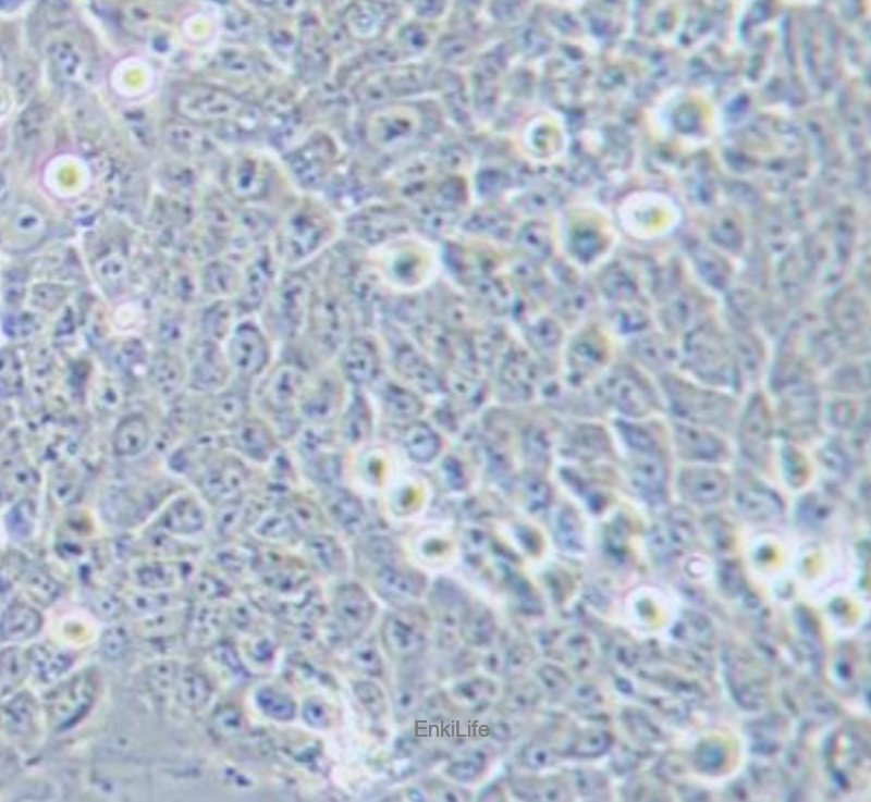人食管癌细胞TE-12(STR鉴定) | EnkiLife恩玑生命