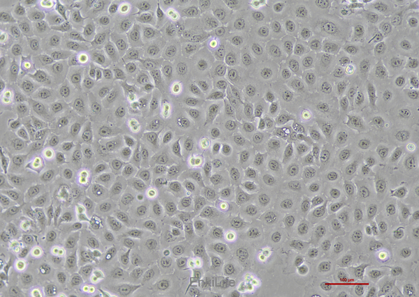 人食管鳞癌细胞KYSE-150(STR鉴定) | EnkiLife恩玑生命