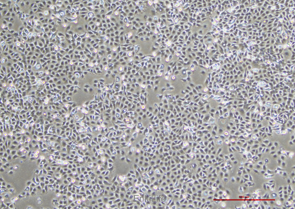人食管鳞癌细胞KYSE-150(STR鉴定) | EnkiLife恩玑生命