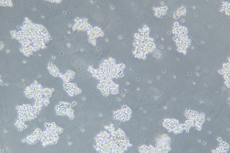 人视网膜母细胞瘤细胞Y79(STR鉴定) | EnkiLife恩玑生命