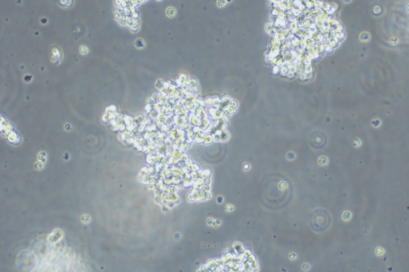 人视网膜母细胞瘤细胞Y79(STR鉴定) | EnkiLife恩玑生命