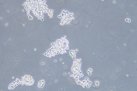 人视网膜神经胶质瘤细胞WERI-RB-1(STR鉴定) | EnkiLife恩玑生命