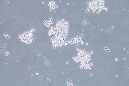 人视网膜神经胶质瘤细胞WERI-RB-1(STR鉴定) | EnkiLife恩玑生命