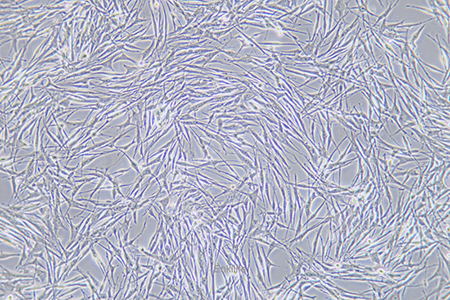 人胎盘绒膜癌细胞BeWo(STR鉴定) | EnkiLife恩玑生命
