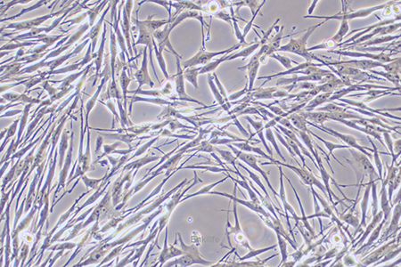 人胎盘绒膜癌细胞BeWo(STR鉴定) | EnkiLife恩玑生命