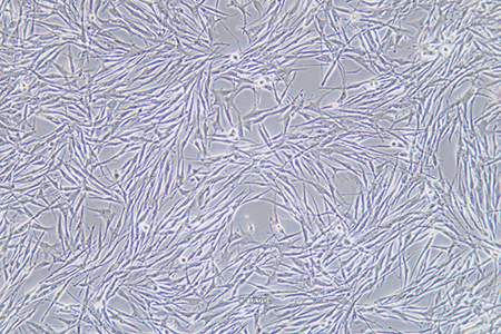 人胎盘绒膜癌细胞BeWo(STR鉴定) | EnkiLife恩玑生命