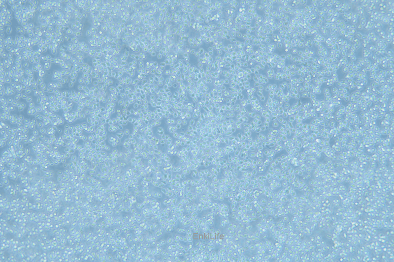 人套细胞淋巴瘤细胞Z-138(STR鉴定) | EnkiLife恩玑生命