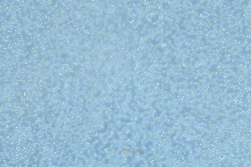 人套细胞淋巴瘤细胞Z-138(STR鉴定) | EnkiLife恩玑生命