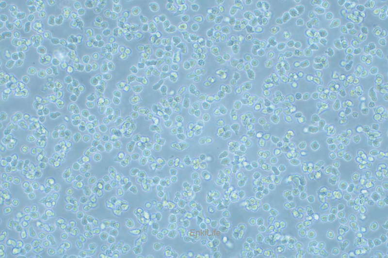 人套细胞淋巴瘤细胞Z-138(STR鉴定) | EnkiLife恩玑生命