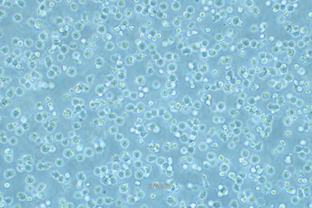 人外周血套细胞淋巴瘤细胞MINO(STR鉴定) | EnkiLife恩玑生命
