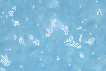 人胃癌细胞SNU-16(STR鉴定) | EnkiLife恩玑生命