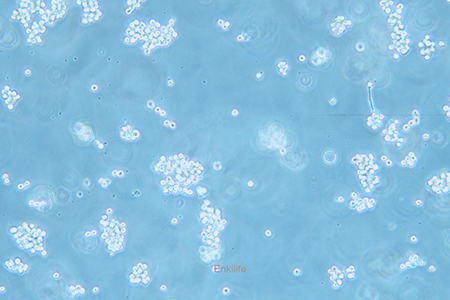 人胃癌细胞SNU-16(STR鉴定) | EnkiLife恩玑生命