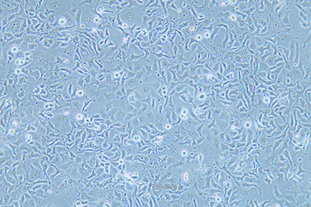 人小细胞肺癌细胞DMS 114(STR鉴定) | EnkiLife恩玑生命