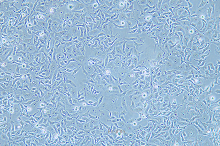 人小细胞肺癌细胞DMS 114(STR鉴定) | EnkiLife恩玑生命