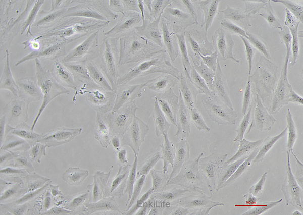 人小细胞肺癌细胞NCI-H196 [H196](STR鉴定) | EnkiLife恩玑生命