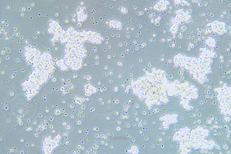 人小细胞肺癌细胞SHP-77(STR鉴定) | EnkiLife恩玑生命