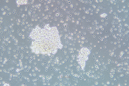人小细胞肺癌细胞SHP-77(STR鉴定) | EnkiLife恩玑生命